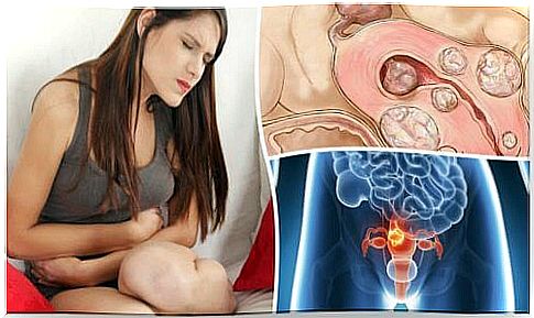 5 facts to know about uterine fibroid