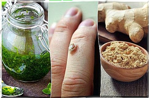 5 natural remedies to get rid of warts