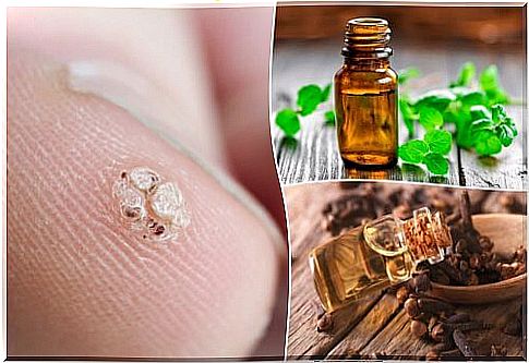 7 essential oils to remove warts