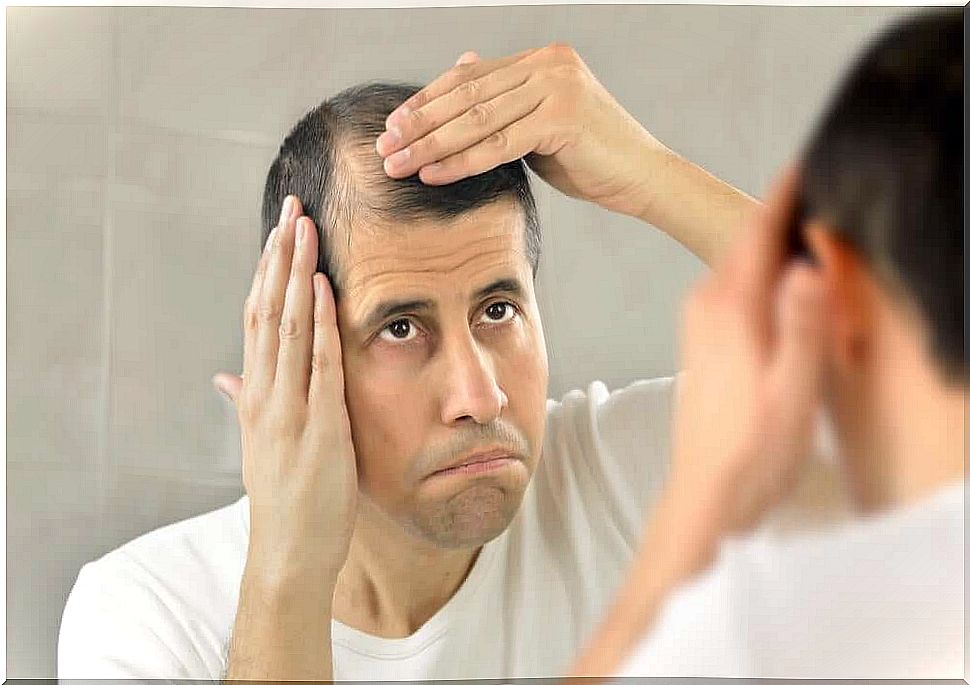 Man with androgenetic alopecia