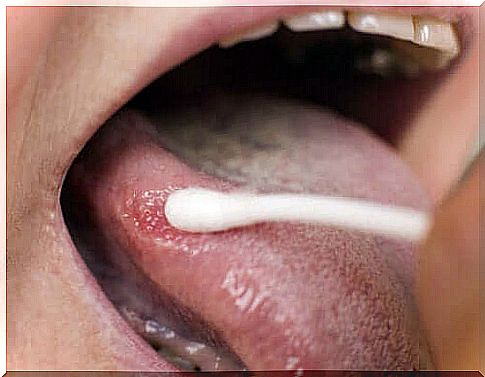 Black spots on the tongue: what are they due to?