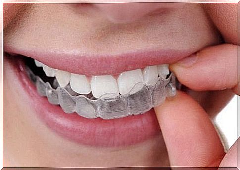 Bruxism?  Here's how to treat it!