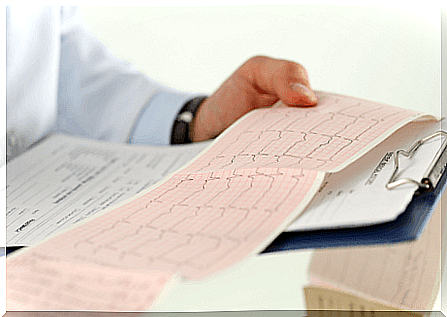 Doctor reads an electrocardiogram