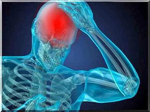 Headache X-ray.