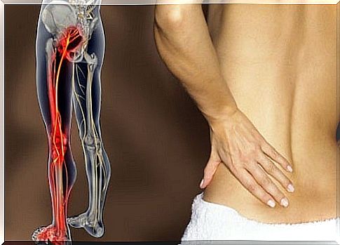 inflammation of sciatica