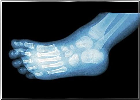 foot x-ray