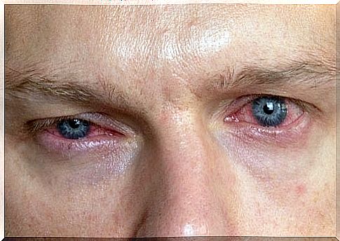 Herpetic keratitis: how to recognize it?