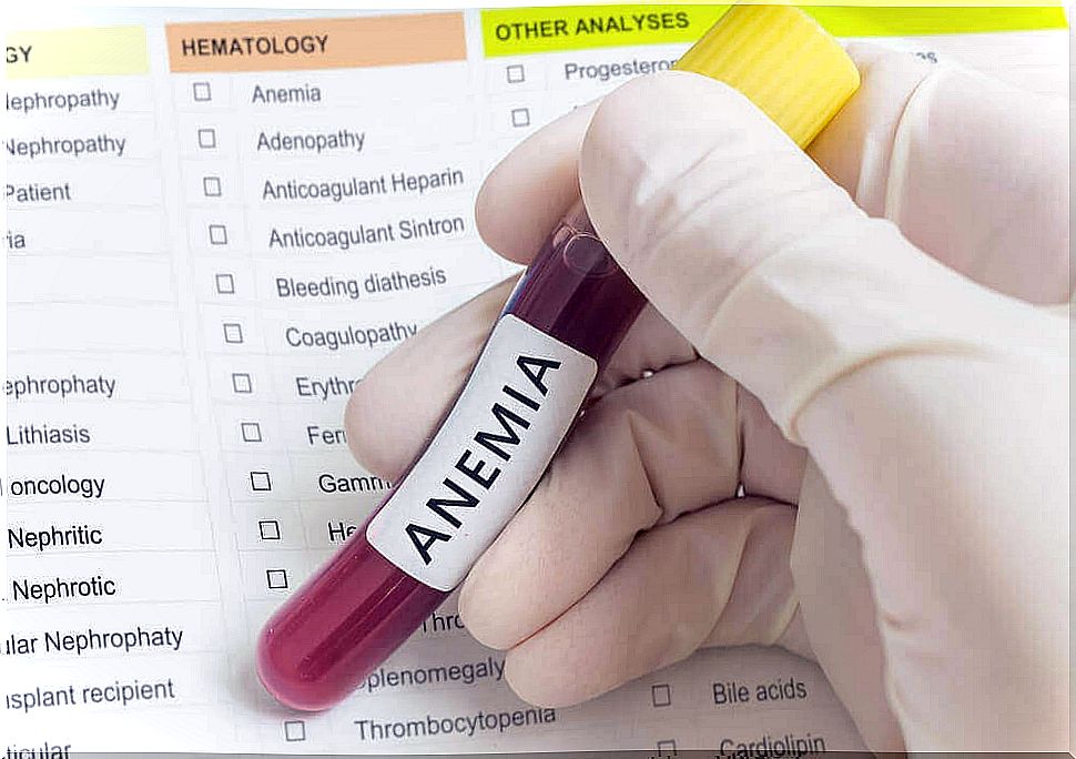 Iron deficiency anemia