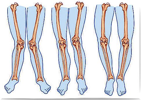 Types of legs.