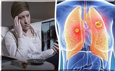 Lung cancer mainly affects women