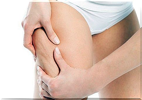 Remedies for cellulite