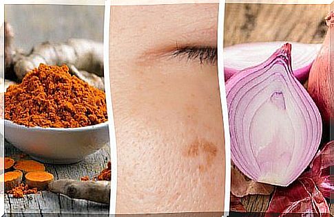 Skin macules: 6 natural remedies to eliminate them