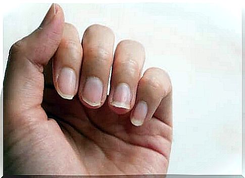 Strengthen your nails naturally?  5 tips