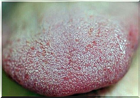 Tongue seen up close