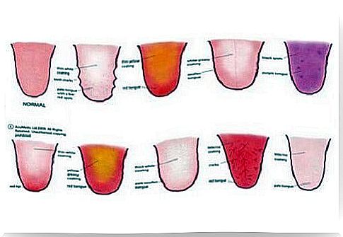 Appearance of the tongue